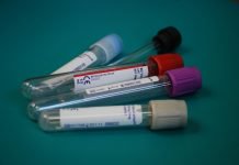 Few Boomers Screened for Hep C