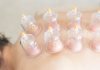 Exploring Cupping