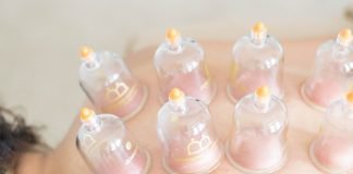 Exploring Cupping